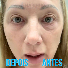 Creme Antirrugas Instantâneo DermaSkin